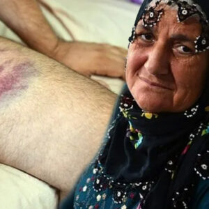 yil oldu kackadina miras yok deyip oglunu dovduler DOJ9dhEi